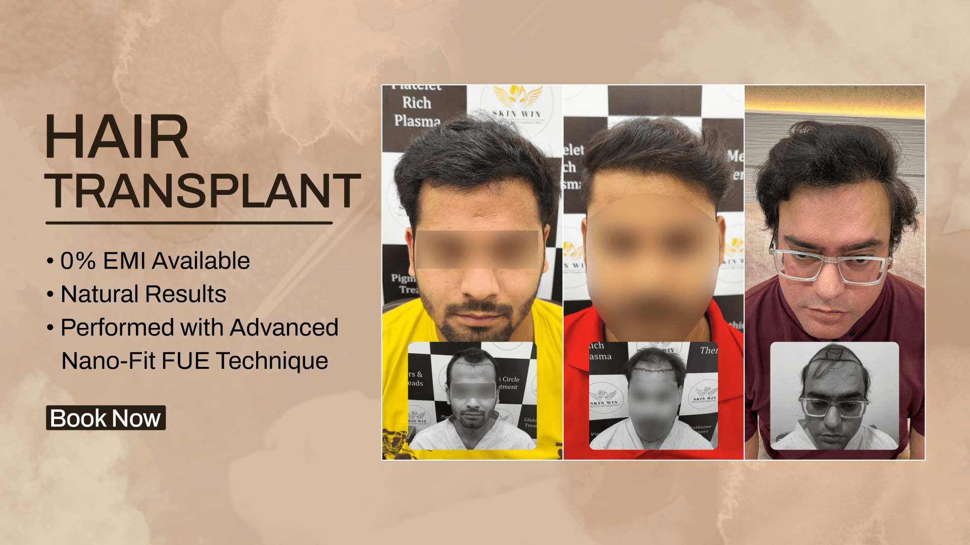 Restore Your Hair. Regain Your Confidence.