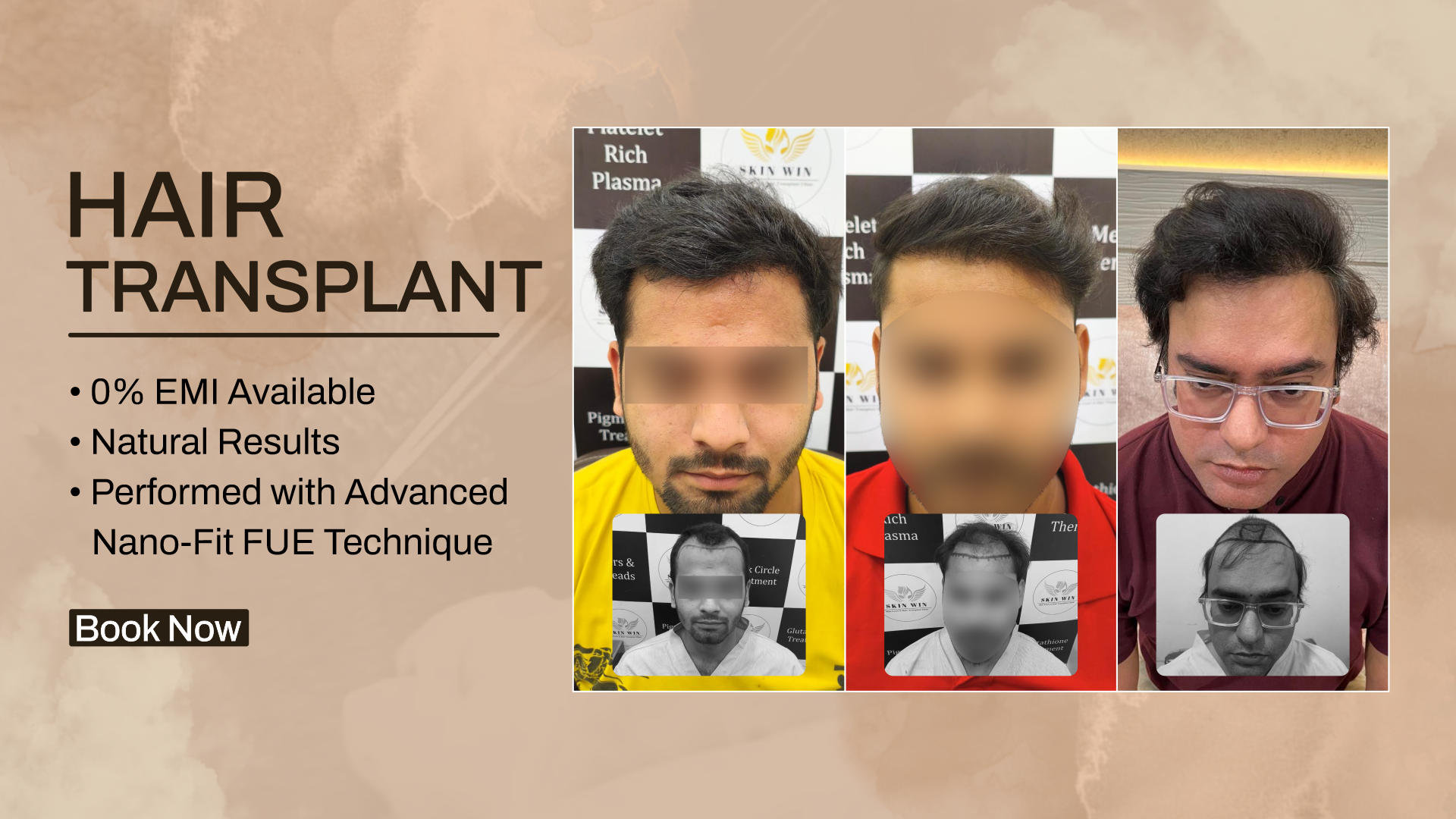 Restore Your Hair. Regain Your Confidence.